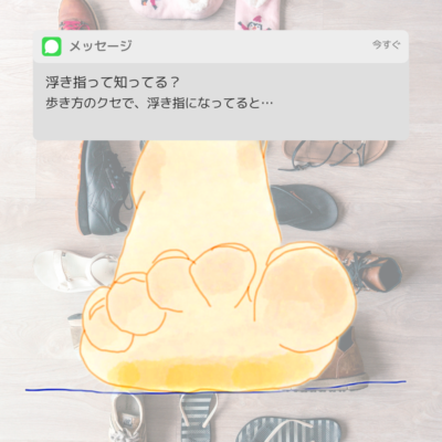 巻き爪の原因…